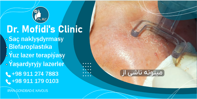 Лазерная терапия для лица